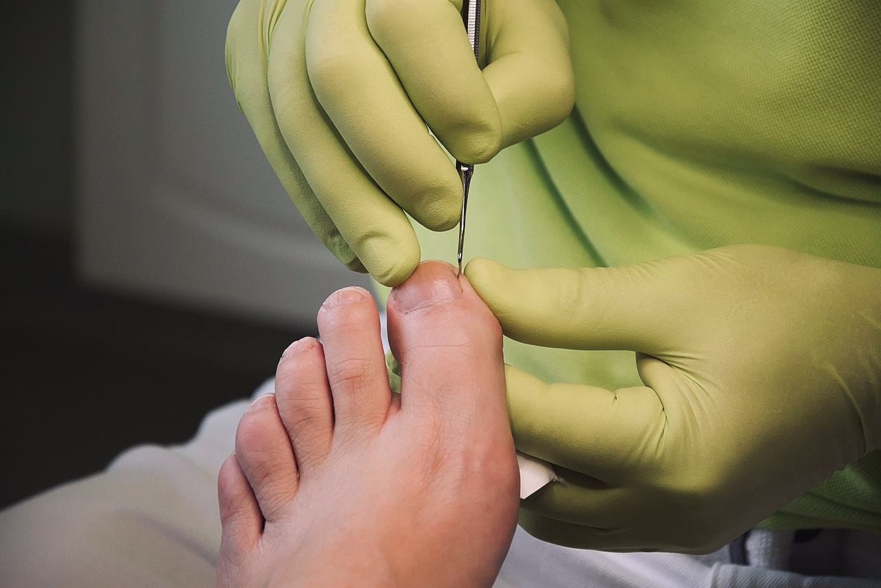 Soin des pieds